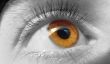 eye macro