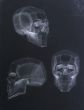 Human Skull