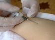 nurse hand with syringe doing injection