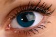 beautiful blue eye