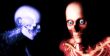 Human Bones