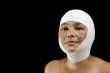 Plastic surgery