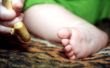 Infant foot and hand fingers with cracknel