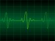 Heart cardiogram