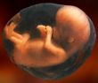 Fetus at Eight Weeks