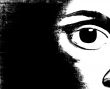 Black eye