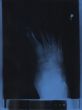 x-ray