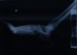 x-ray