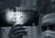 Doctor with x-ray