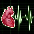 Heart Monitor