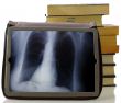 Radiography