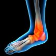 Ankle pain - detail