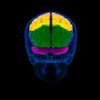 Colored sections of a human brain-cerebrum -