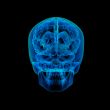 Human brain X ray