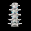 spinal disc
