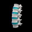 spinal disc