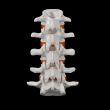 spinal disc