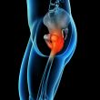 painful hip joint