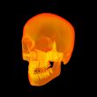 Isolated human x ray skull on black background