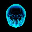 Isolated human x ray skull on black background 