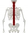 Skeleton of the man with the backache.