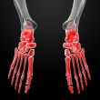 3d render human foot x-ray