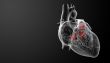 3d render Heart valve - side view