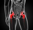 painful hip joint
