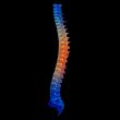 3d render painful spine