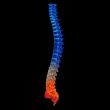 3d render painful spine