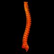 3d render painful spine