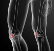 3d render illustration patella