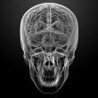Human brain X ray 