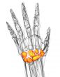 3d render medical illustration of the carpal bone