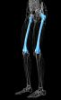 3d render medical illustration of the femur bone