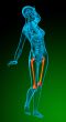 3d render medical illustration of the femur bone 