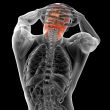 3d render medical illustration of the human skull 