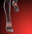  midfoot bone 